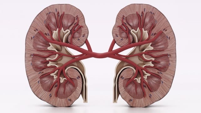 renal cell carcinoma